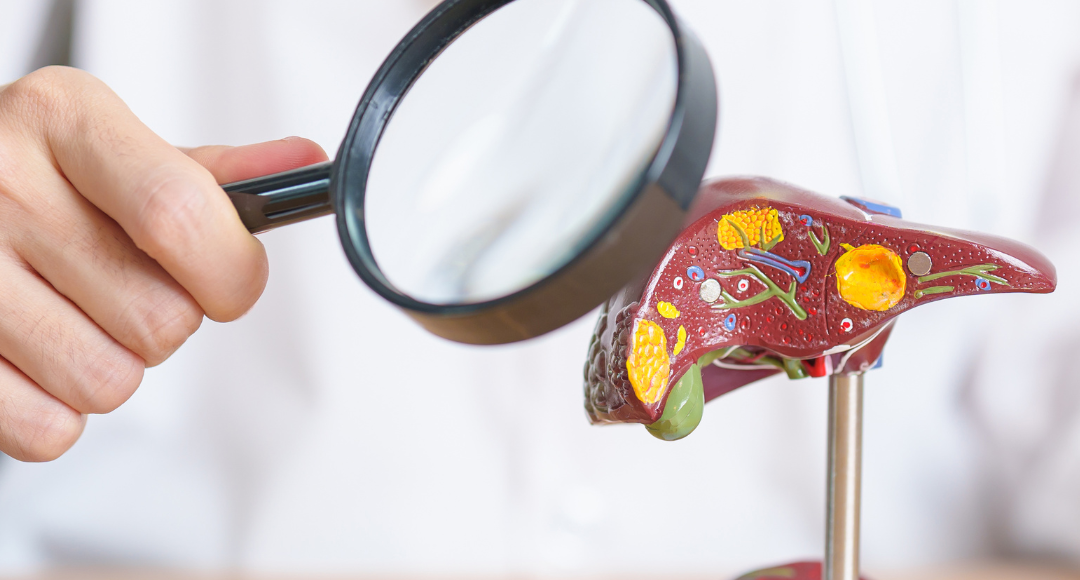 wirusowe zapalenie wątroby