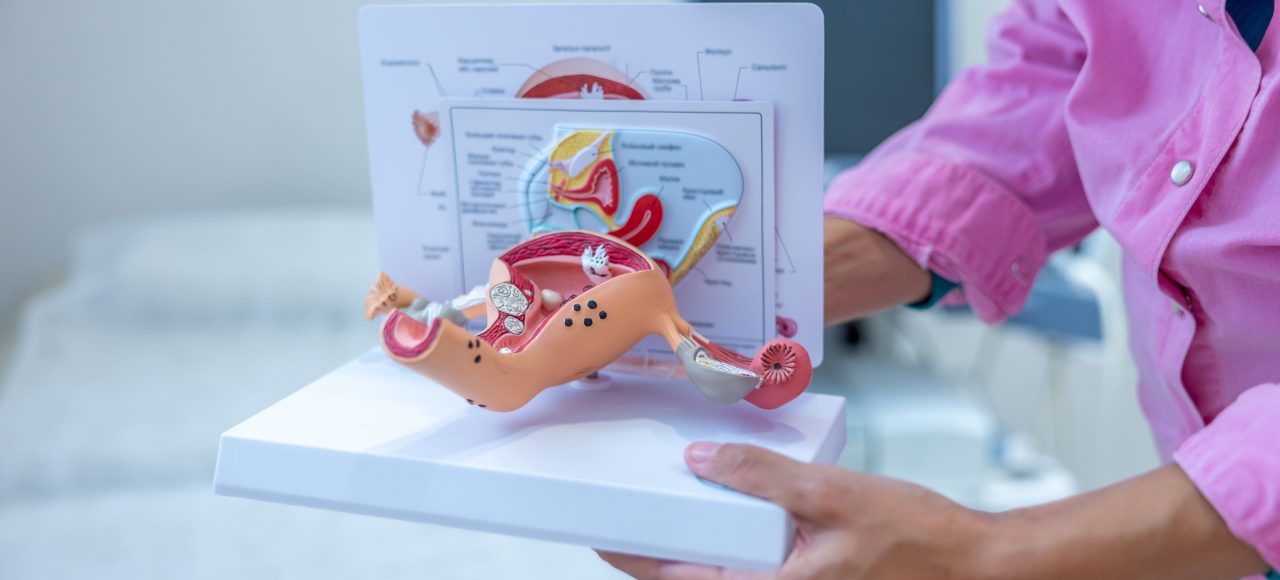 Polip macicy – czy jest groźny dla zdrowia