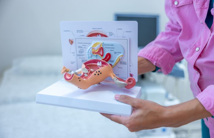 Polip macicy – czy jest groźny dla zdrowia