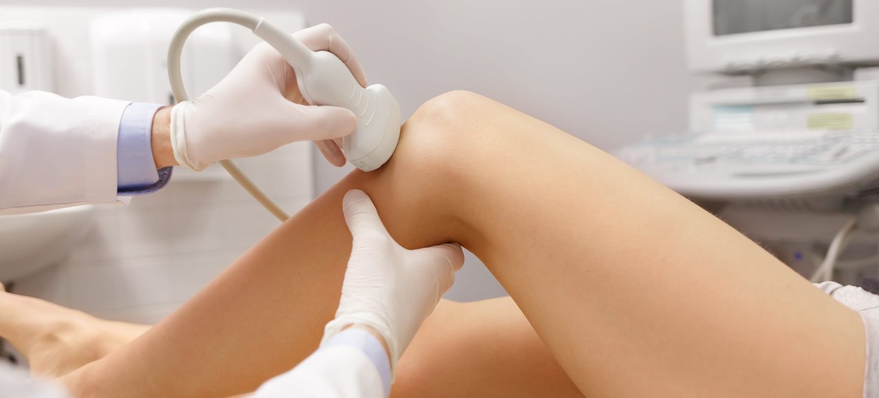 USG doppler żył kończyn dolnych