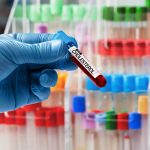 Z czego wynika podwyższony cholesterol Z czego wynika podwyższony cholesterol
