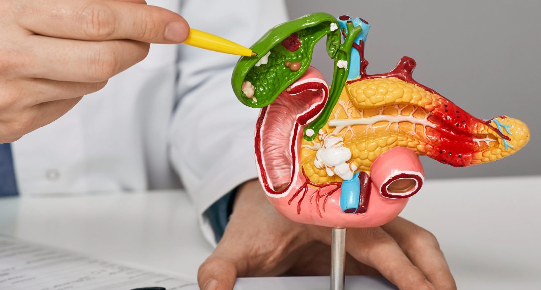 Laparoskopowe usunięcie pęcherzyka żółciowego Globiana Katowice