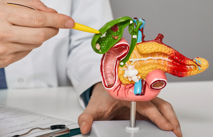 Laparoskopowe usunięcie pęcherzyka żółciowego Globiana Katowice