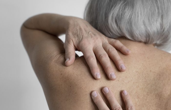 półpasiec a szczepienie